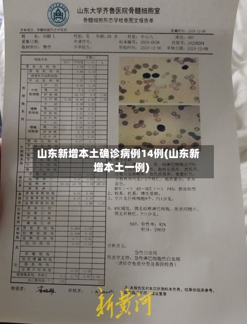 山东新增本土确诊病例14例(山东新增本土一例)