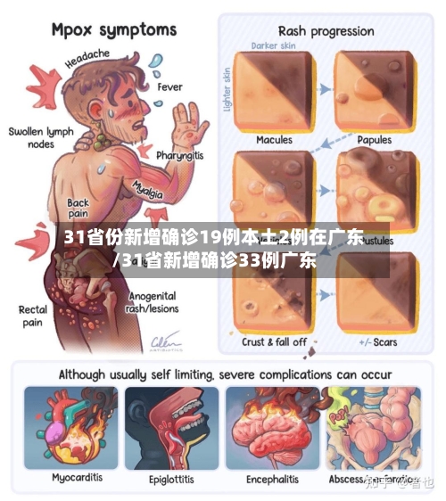 31省份新增确诊19例本土2例在广东/31省新增确诊33例广东
