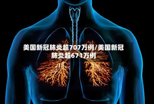 美国新冠肺炎超707万例/美国新冠肺炎超671万例